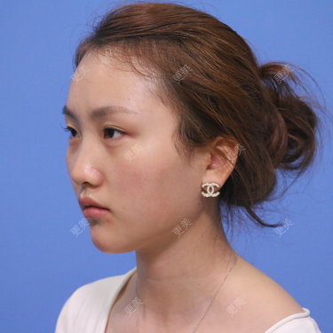 琪琪格布