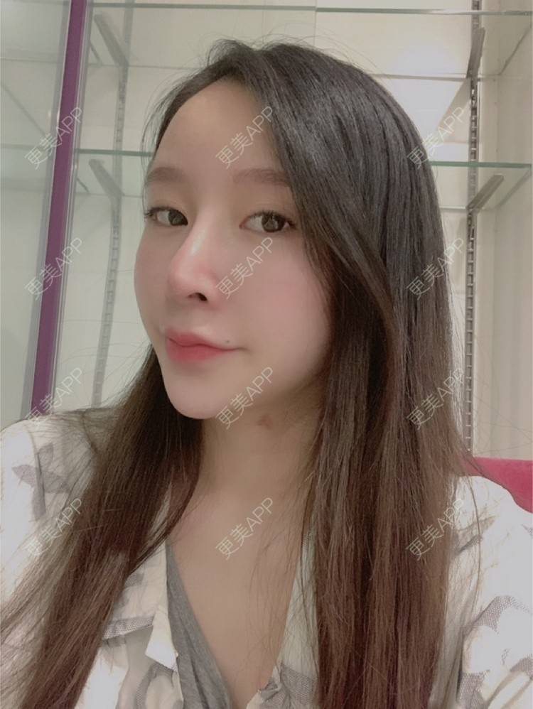 更美 - 小叮当king的除皱瘦脸经验 | 除皱瘦脸 | 重庆