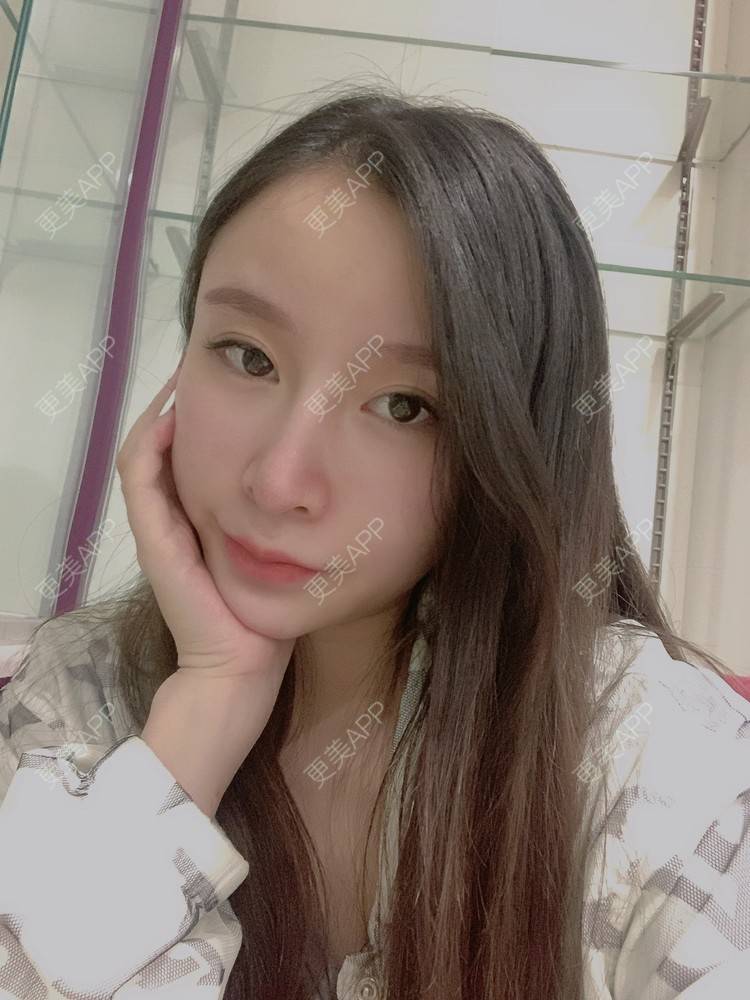 更美 - 小叮当king的除皱瘦脸经验 | 除皱瘦脸 | 重庆