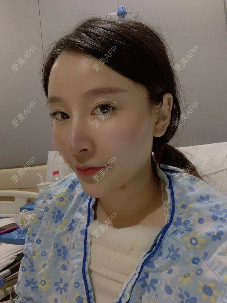 更美 - 小叮当king的除皱瘦脸经验 | 除皱瘦脸 | 重庆