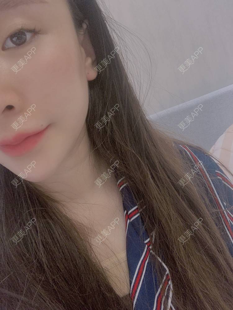 更美 - 小叮当king的除皱瘦脸经验 | 除皱瘦脸 | 重庆