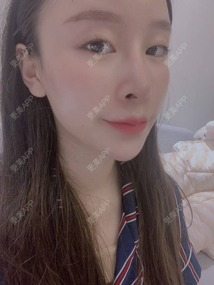 更美 - 小叮当king的除皱瘦脸经验 | 除皱瘦脸 | 重庆