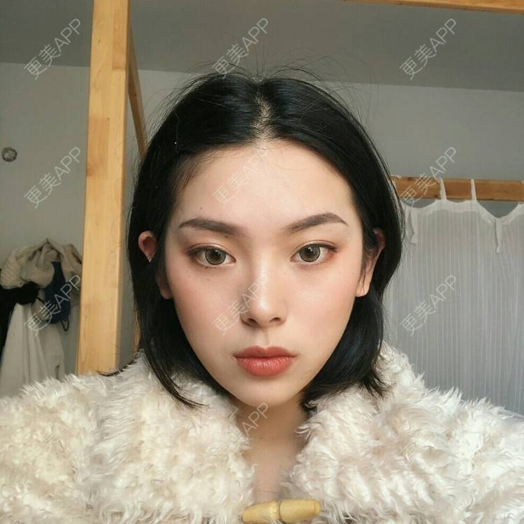 更美 - 杀死.比尔的上下颚手术经验 | 成都 | 上下颚手术 | 颧弓降低 | 全脸整形套餐 | 下颌角切除