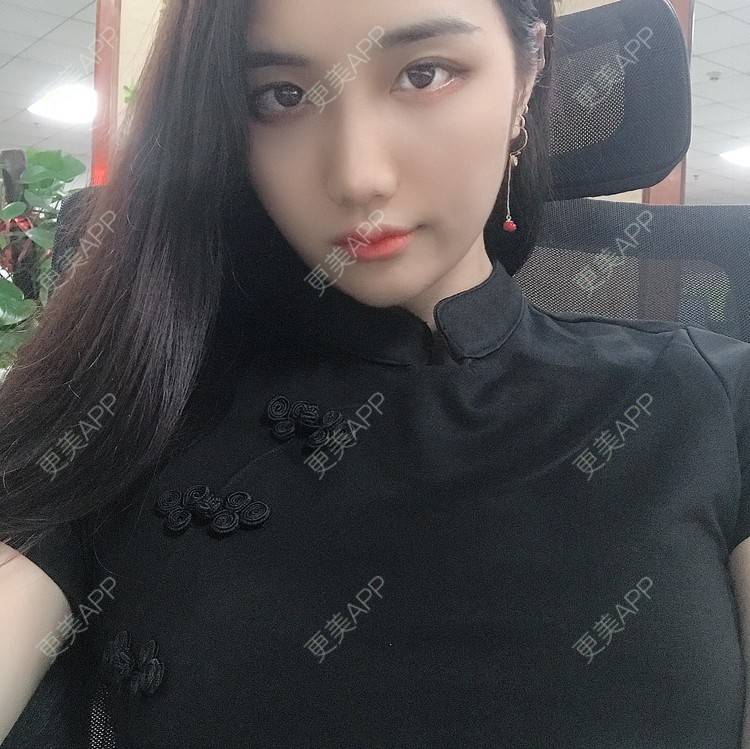 更美 - •你的小可爱•的面部脱毛经验 | 面部脱毛 | 玻尿酸泪沟 | 玻尿酸鼻部 | 玻尿酸下巴 | 深圳