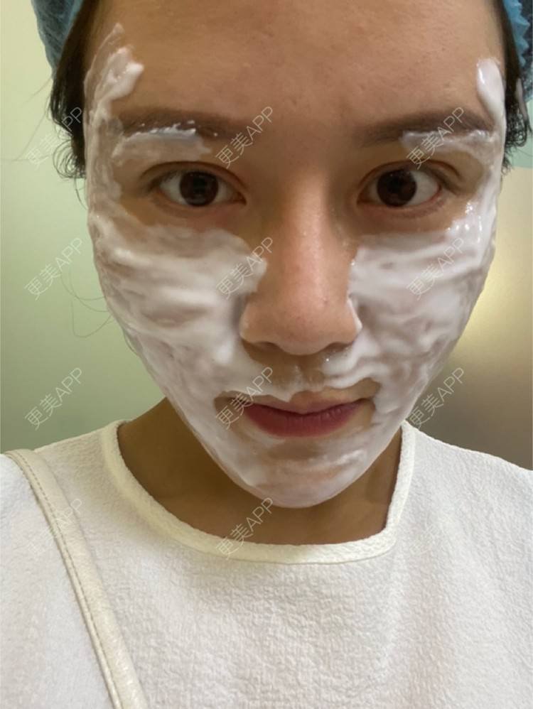 更美 - 你～我心中的结的超声提升经验 | 上海 | 超声提升