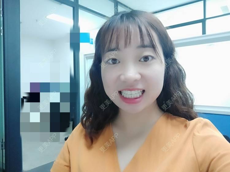 更美 - 橙子Jiang的牙齿矫正经验 | 牙齿矫正 | 成都