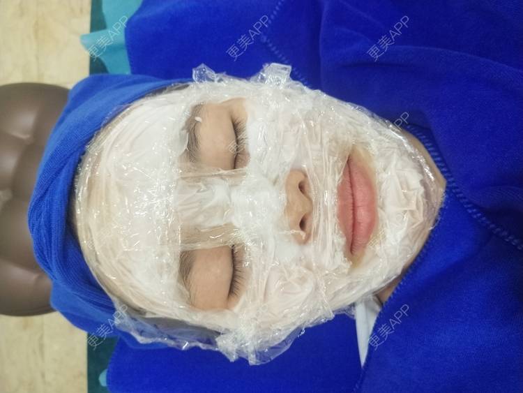 更美 - 鴘鴿的水光项目经验 | 东莞 | 水光项目