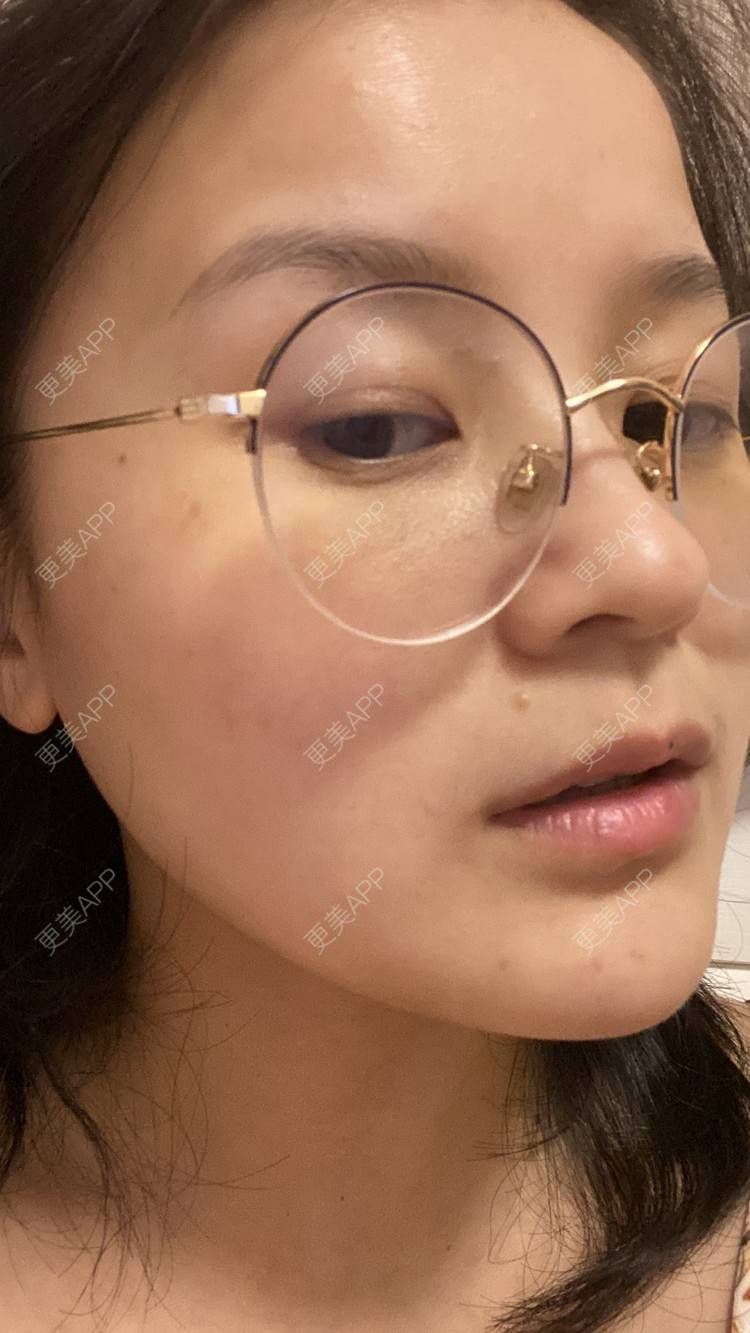 更美 - 一白遮三丑丑丑的热拉提经验 | 上海 | 热拉提