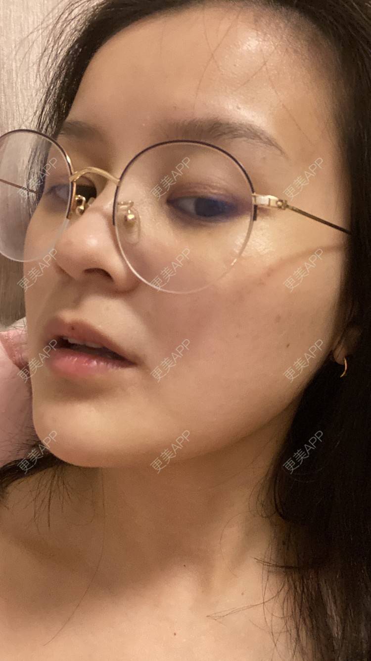 更美 - 一白遮三丑丑丑的热拉提经验 | 上海 | 热拉提