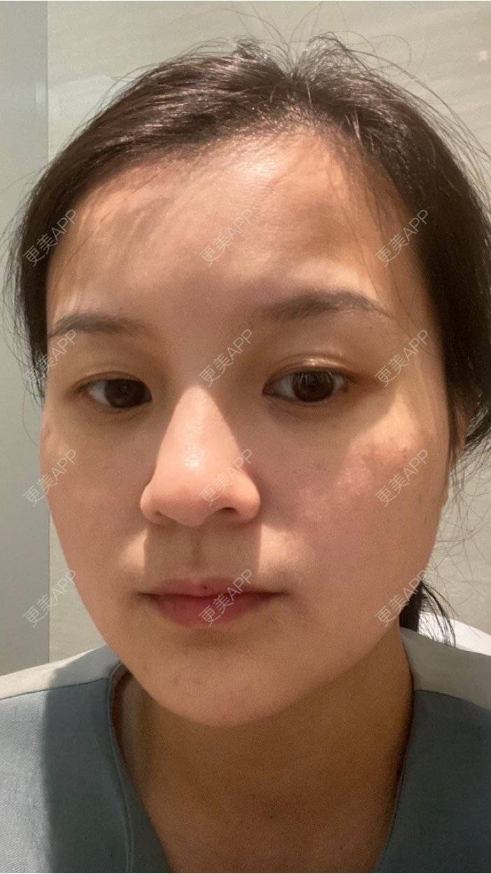 更美 - 一白遮三丑丑丑的热拉提经验 | 上海 | 热拉提