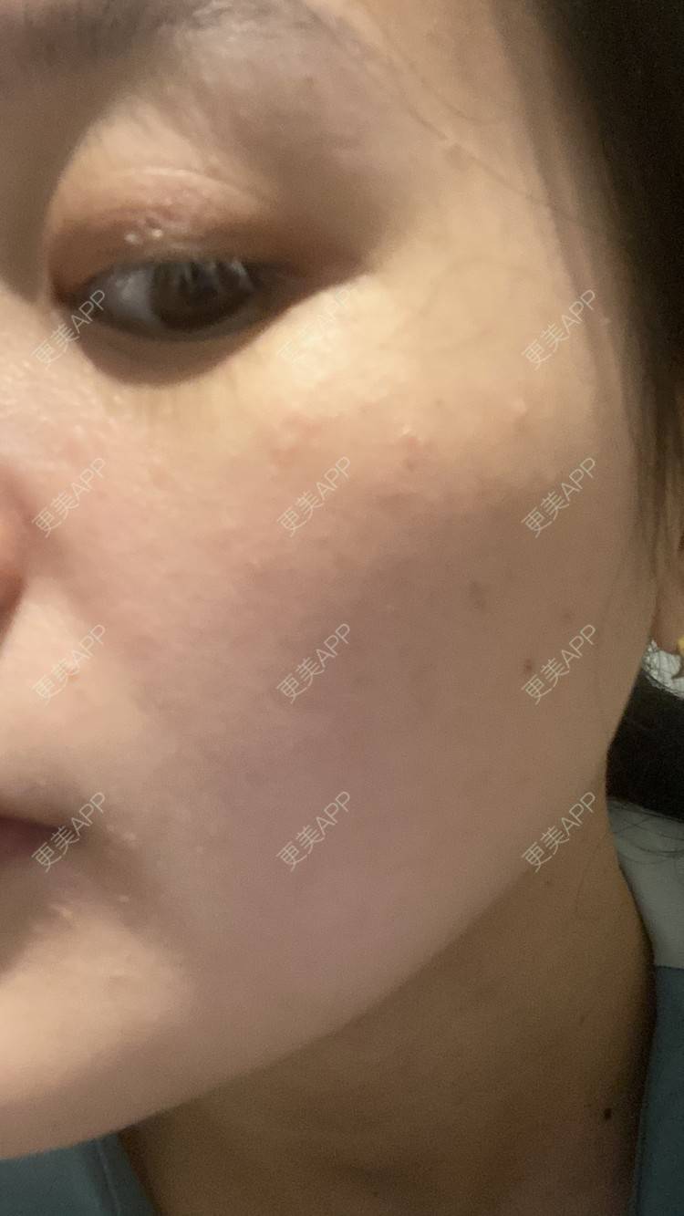 更美 - 一白遮三丑丑丑的热拉提经验 | 上海 | 热拉提