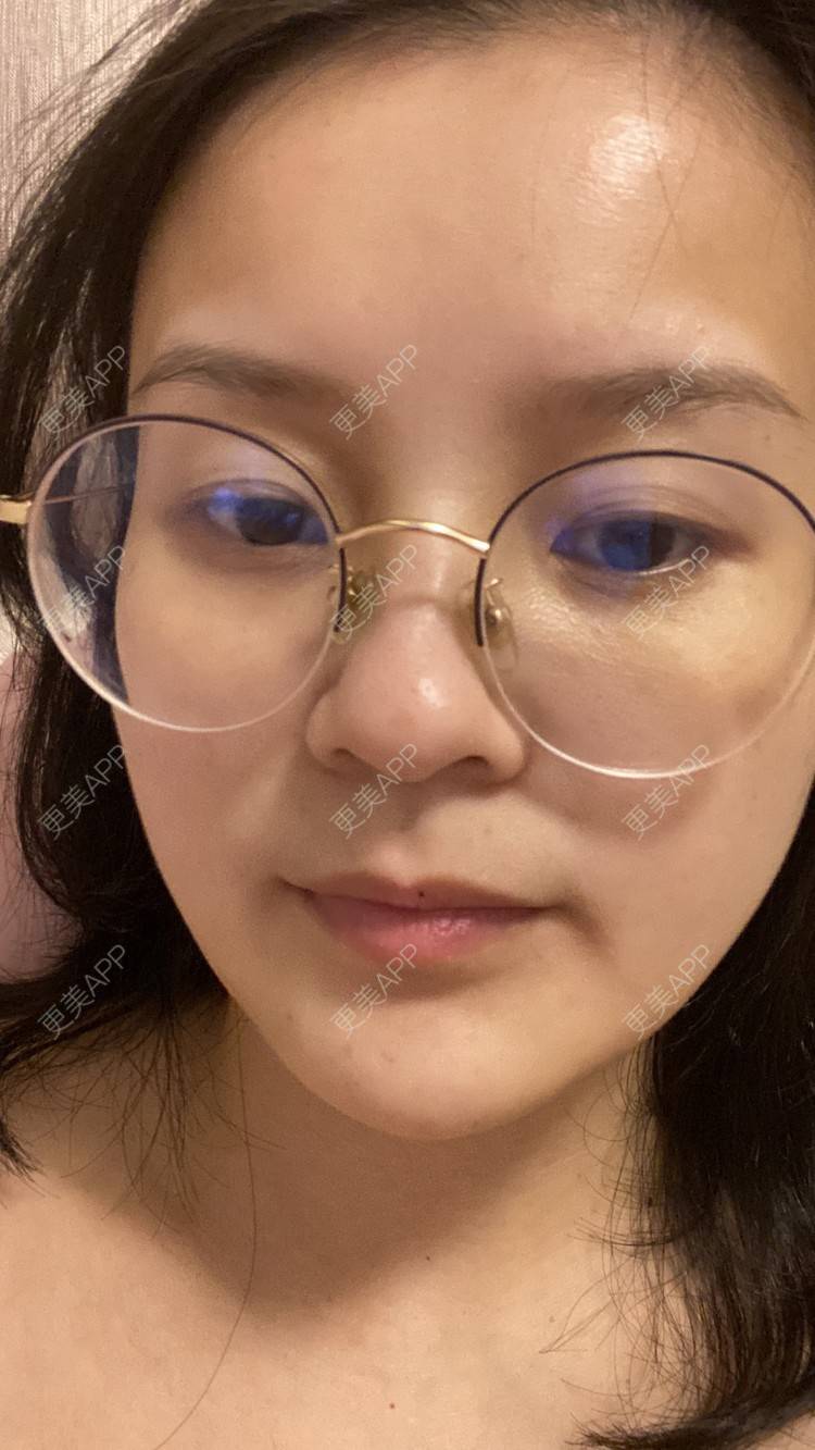 更美 - 一白遮三丑丑丑的热拉提经验 | 上海 | 热拉提