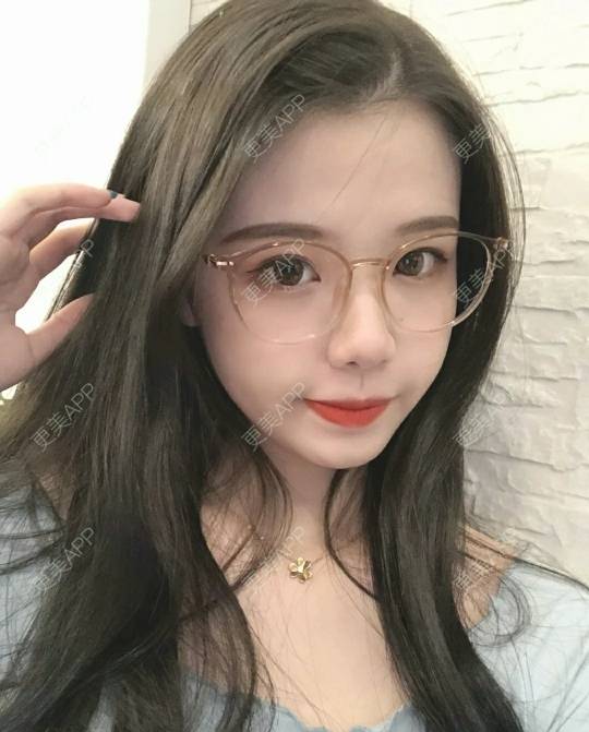 更美 - 更美用户Kl8f5o9g4t的吸脂去副乳经验 | 吸脂去副乳 | 武汉