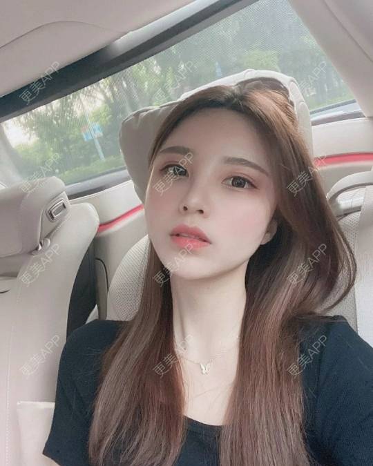 更美 - 更美用户otH3D9HWbq的吸脂去副乳经验 | 吸脂去副乳 | 武汉