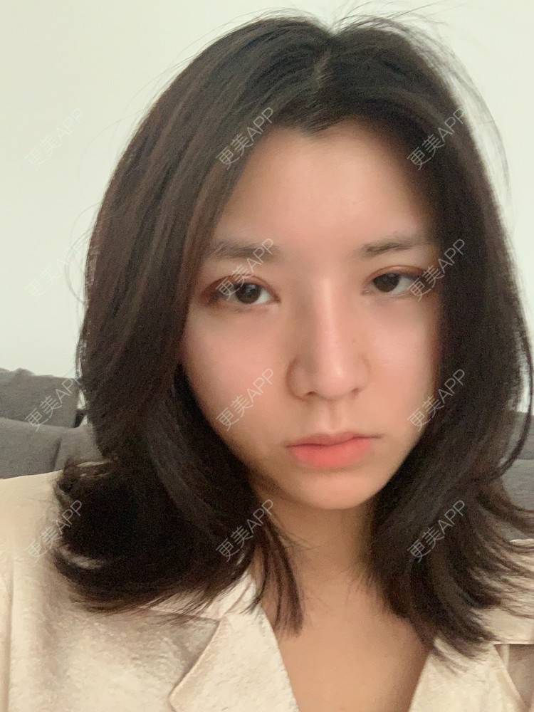 更美 - 更美用户B670A6hUBe的眼部综合经验 | 广州 | 眼部综合