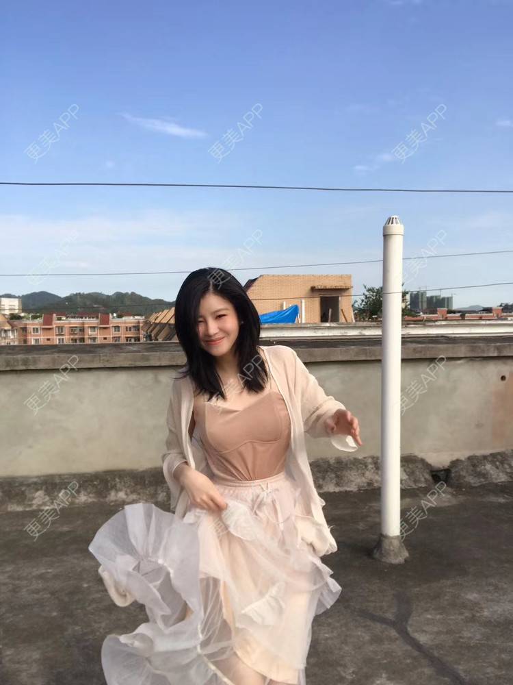 更美 - 叮咯隆咚锵.的鼻部多项经验 | 鼻部多项 | 肋软骨隆鼻 | 鼻中隔软骨垫鼻头 | 成都