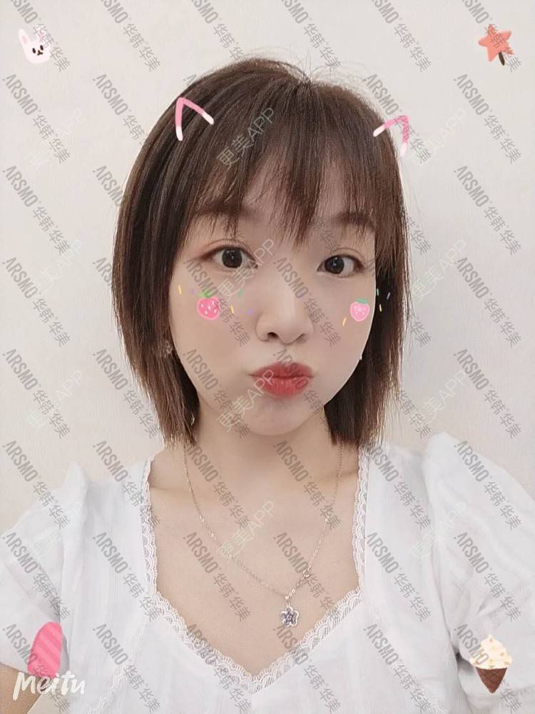更美 - 摘星怪✨的埋线提升经验 | 埋线提升 | 抗衰紧致 | 埋线除皱 | 射频提升 | 除皱套餐 | 长沙