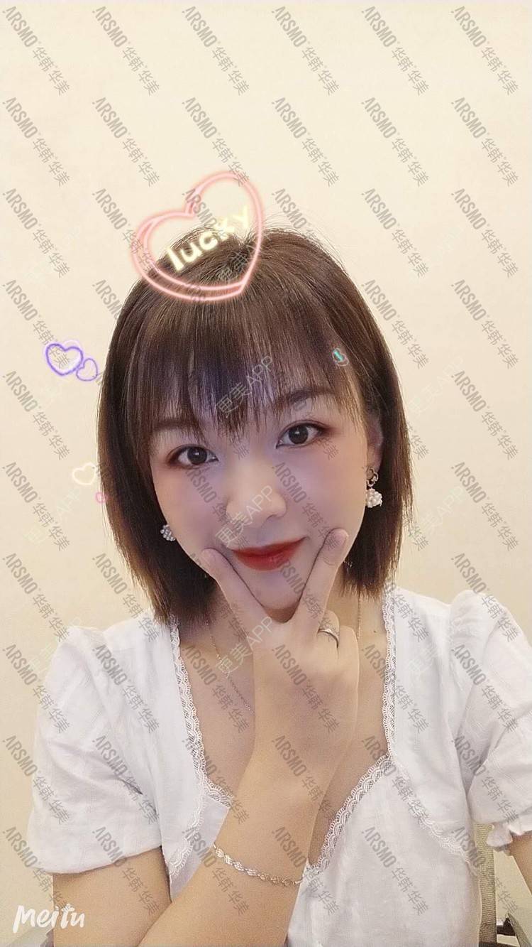 更美 - 摘星怪✨的埋线提升经验 | 埋线提升 | 抗衰紧致 | 埋线除皱 | 射频提升 | 除皱套餐 | 长沙