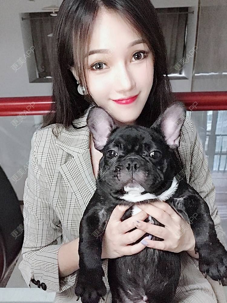 更美 - 美美的芝芝的自体脂肪全面部填充经验 | 广州 | 自体脂肪全面部填充