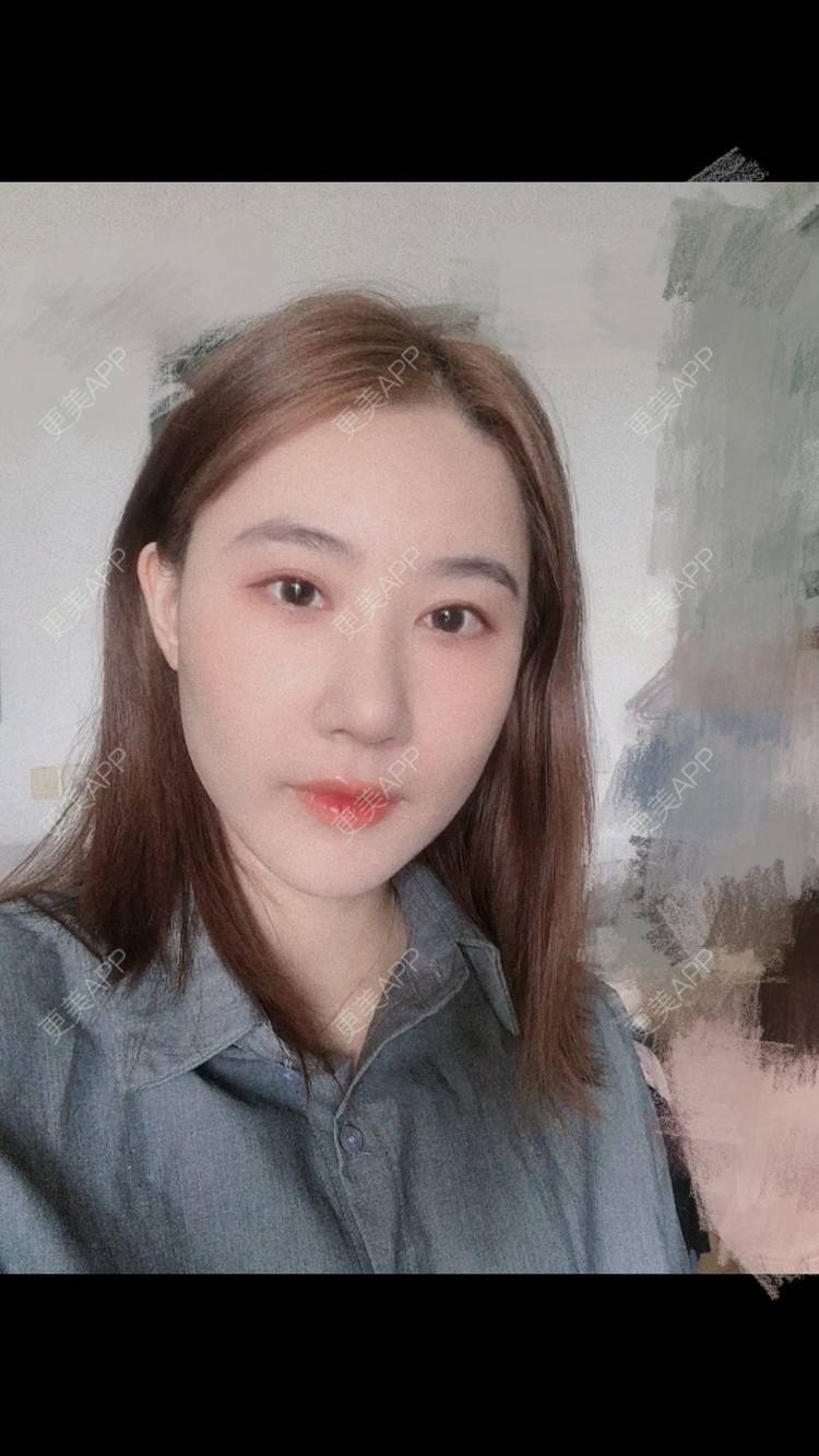更美 - 会魔法的小仙女肛的鼻部多项经验 | 鼻部多项 | 河源
