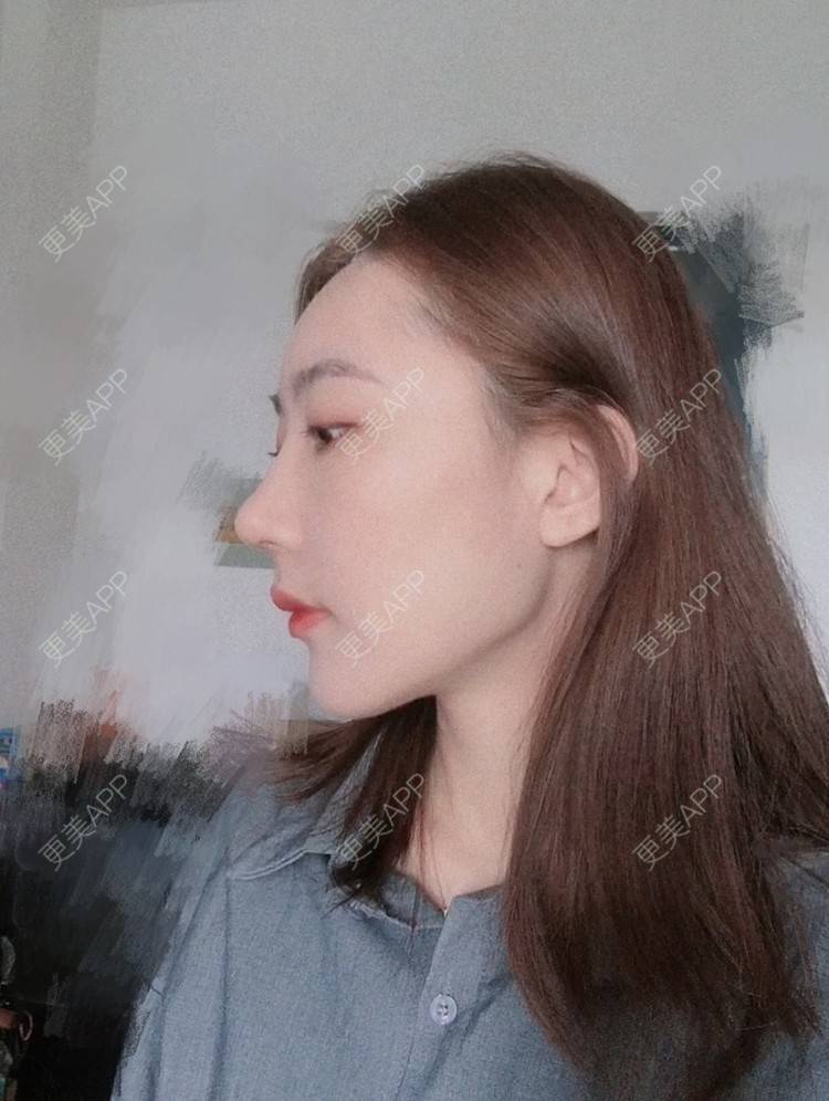 更美 - 会魔法的小仙女肛的鼻部多项经验 | 鼻部多项 | 河源