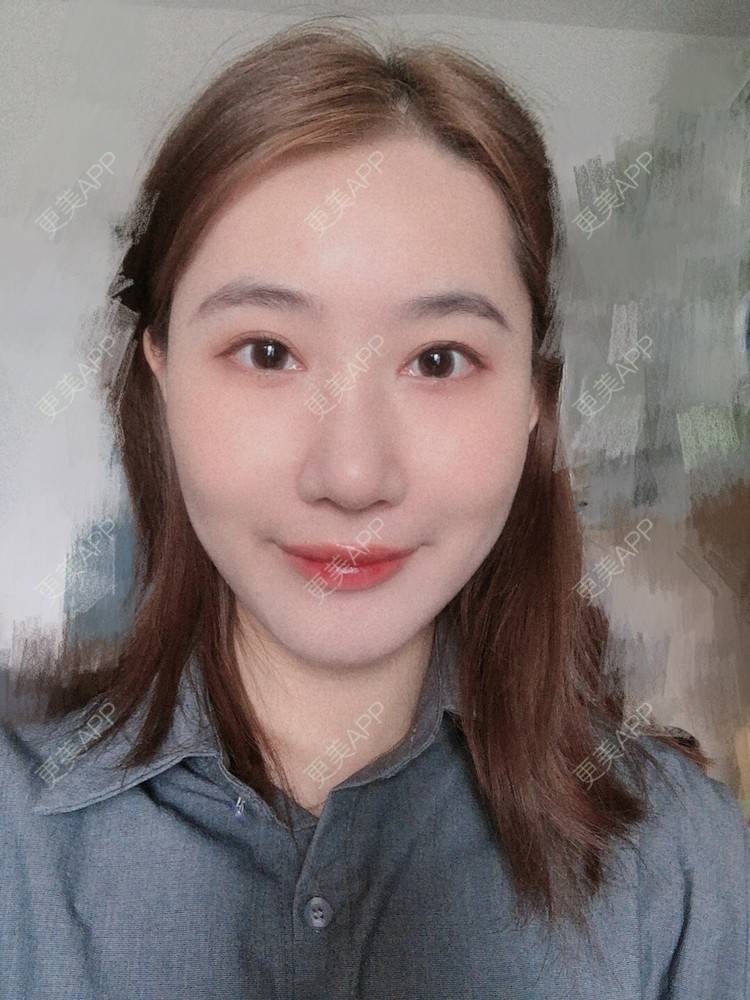 更美 - 会魔法的小仙女肛的鼻部多项经验 | 鼻部多项 | 河源