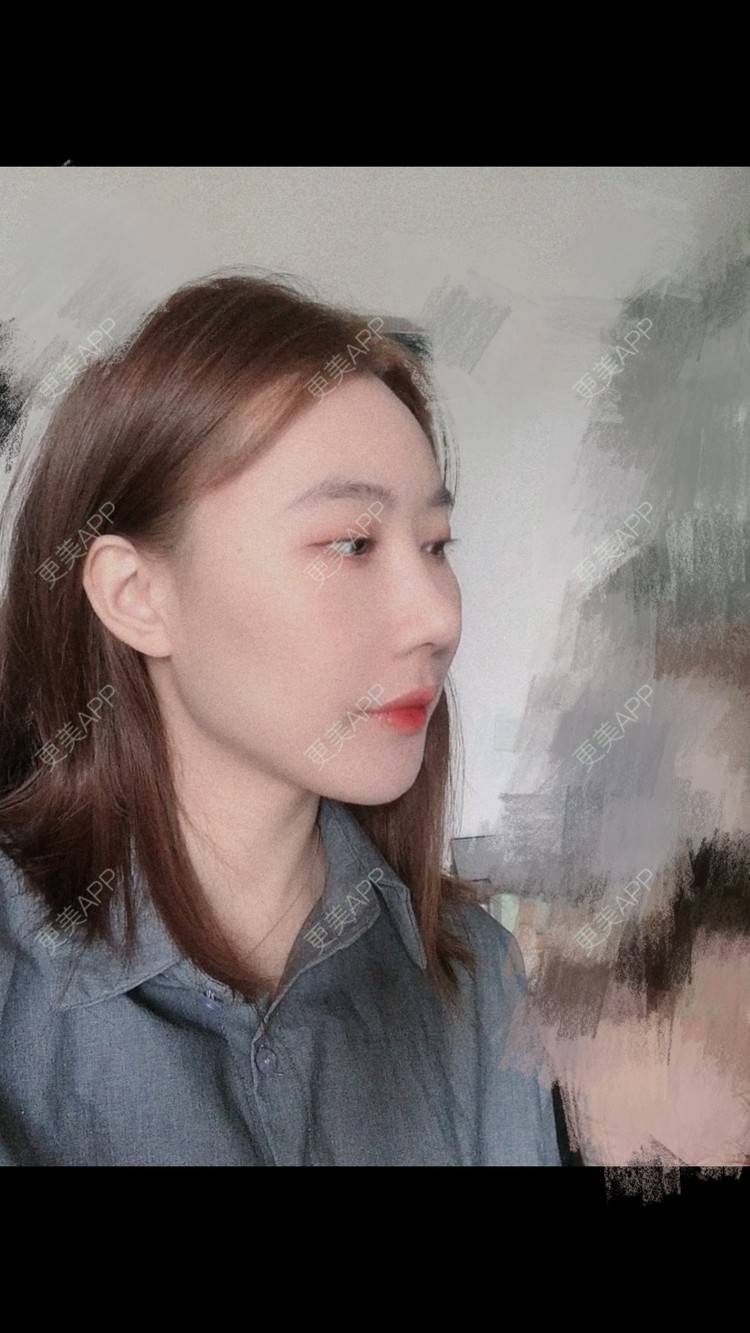 更美 - 会魔法的小仙女肛的鼻部多项经验 | 鼻部多项 | 河源