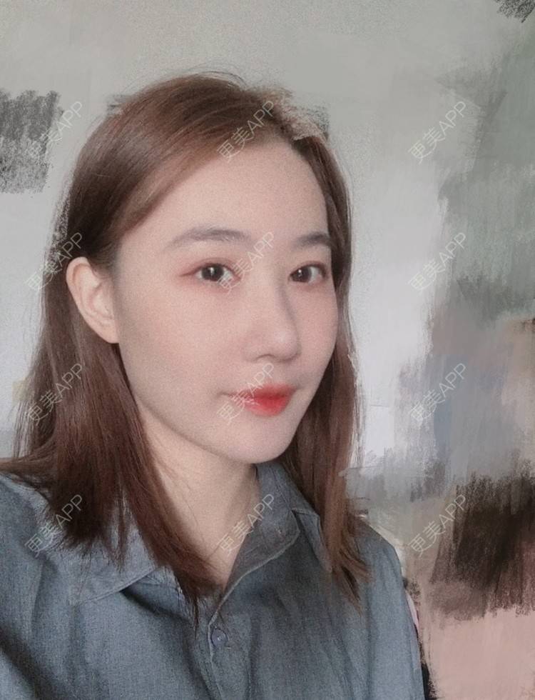 更美 - 会魔法的小仙女肛的鼻部多项经验 | 鼻部多项 | 河源