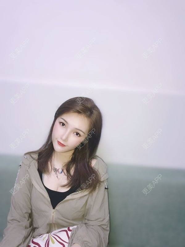 更美 - 美美的芝芝的自体脂肪全面部填充经验 | 广州 | 自体脂肪全面部填充