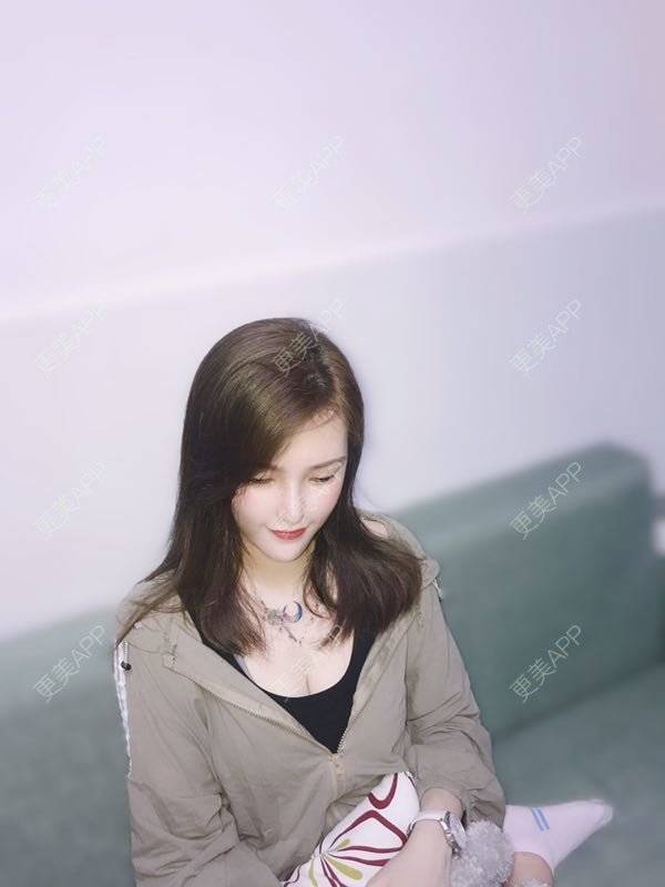 更美 - 美美的芝芝的自体脂肪全面部填充经验 | 广州 | 自体脂肪全面部填充