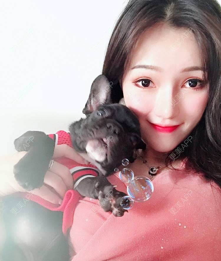 更美 - 美美的芝芝的自体脂肪全面部填充经验 | 广州 | 自体脂肪全面部填充