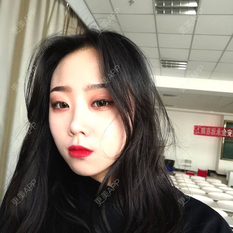 更美 - 更美用户vFETzv4uga的自体脂肪全面部填充经验 | 广州 | 自体脂肪全面部填充