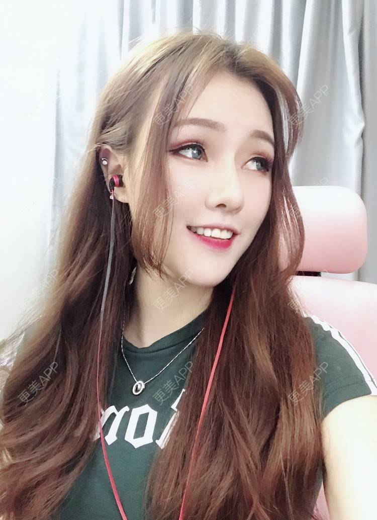 更美 - 美美的芝芝的自体脂肪全面部填充经验 | 广州 | 自体脂肪全面部填充