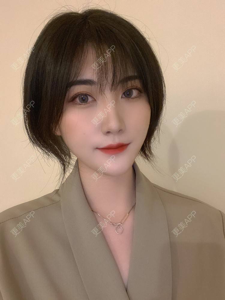 更美 - 更美用户N9t2Gj8Ray的真皮隆鼻经验 | 真皮隆鼻 | 重庆