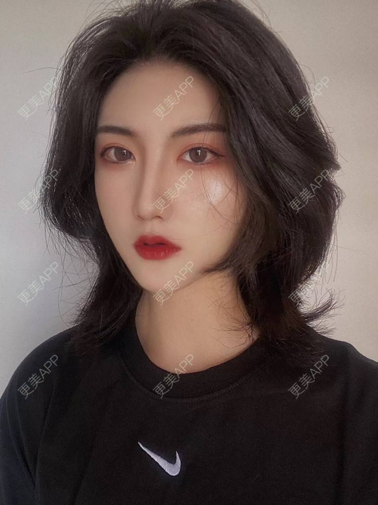 更美 - 更美用户N9t2Gj8Ray的真皮隆鼻经验 | 真皮隆鼻 | 重庆