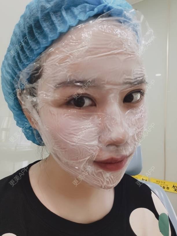 更美 - 更美用户DTmSflJ12H的淡斑套餐经验 | 上海 | 淡斑套餐