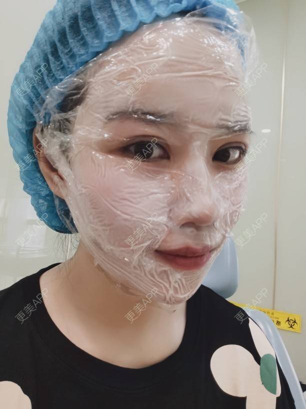 更美 - 更美用户DTmSflJ12H的淡斑套餐经验 | 上海 | 淡斑套餐