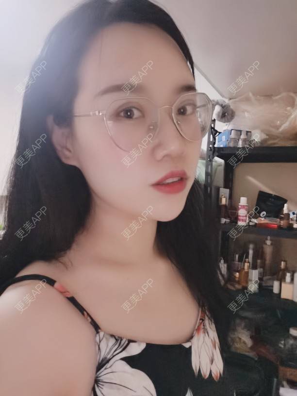 更美 - 更美用户DTmSflJ12H的淡斑套餐经验 | 上海 | 淡斑套餐