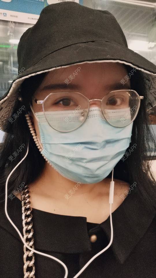 更美 - 更美用户DTmSflJ12H的淡斑套餐经验 | 上海 | 淡斑套餐