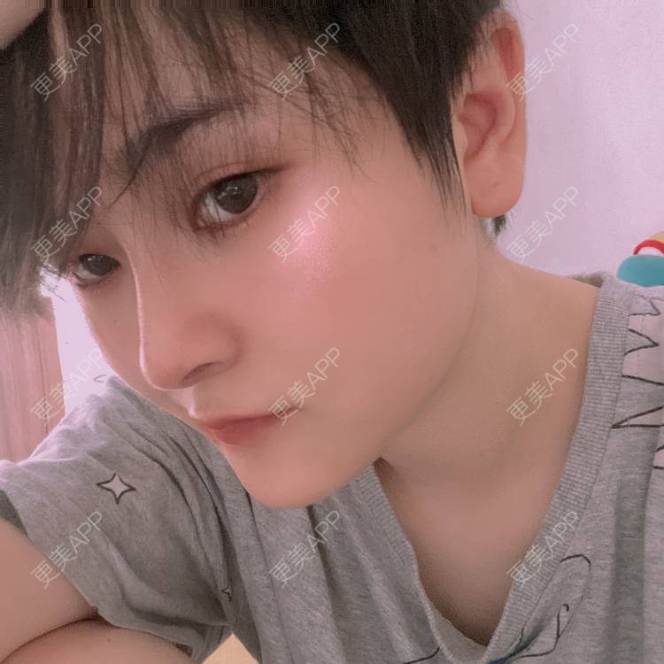 更美 - 全酷开区的下巴经验 | 膨体垫下巴 | 下巴截骨前移 | 双下巴溶脂 | 宽下巴矫正 | 人工骨垫下巴 | 手术缩鼻头 | 自体软骨垫鼻尖 | 硅胶垫下巴 | 胶原蛋白丰下巴 | 鼻小柱延长 | 耳软骨隆鼻
