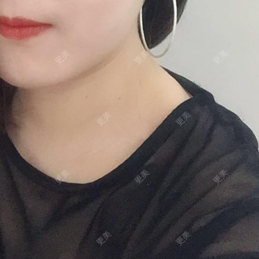 蕶亂の嗳杀
