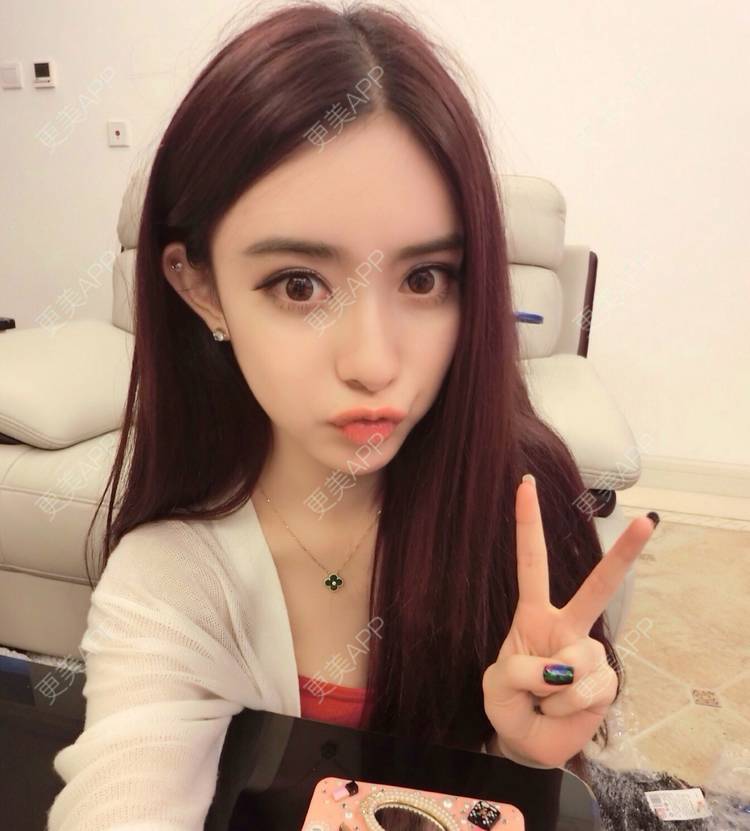 更美 - 更美用户OtY6Ve8v7g的眼部多项经验 | 眼部多项 | 武汉