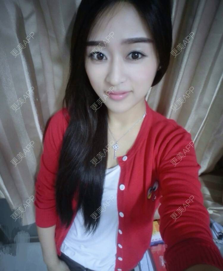 更美 - 更美用户KFrItAJyXA的眼部多项经验 | 眼部多项 | 武汉