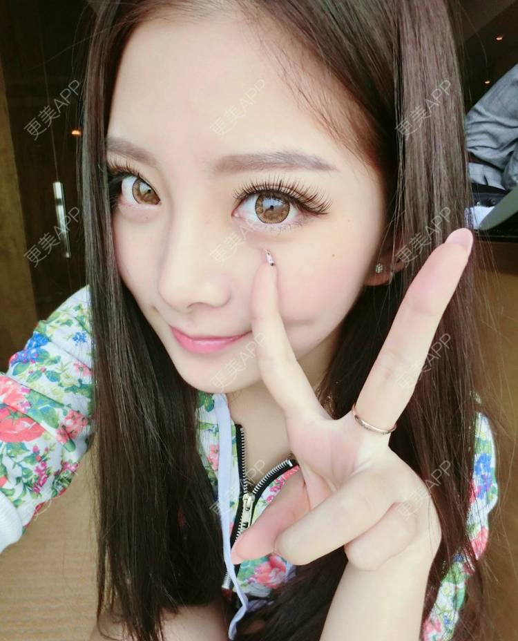 更美 - 更美用户NXsSoxQMuW的眼部多项经验 | 眼部多项 | 武汉