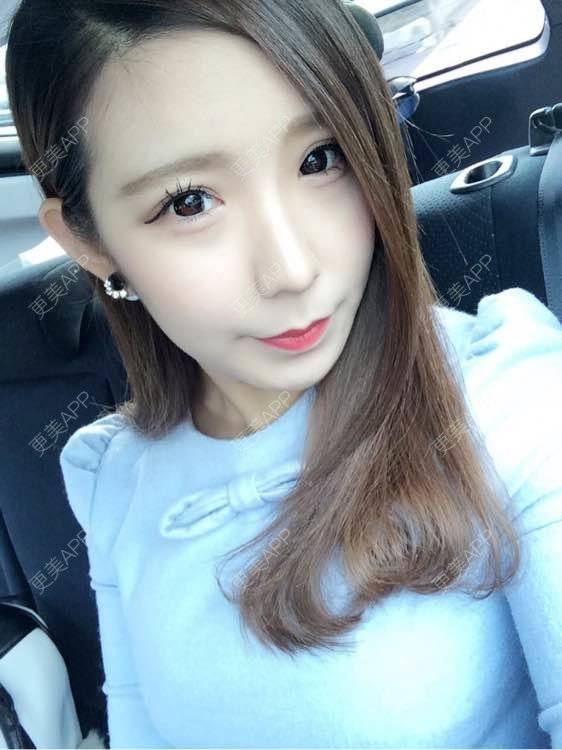 更美 - 更美用户6oikomSeSp的眼部多项经验 | 眼部多项 | 武汉