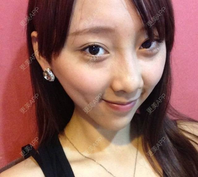 更美 - 更美用户nFJDy0VD81的眼部多项经验 | 眼部多项 | 武汉