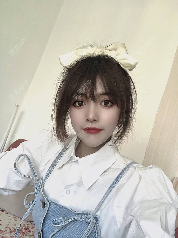 更美 - 更美用户AVBbYHqBLB的真皮隆鼻经验 | 真皮隆鼻 | 重庆