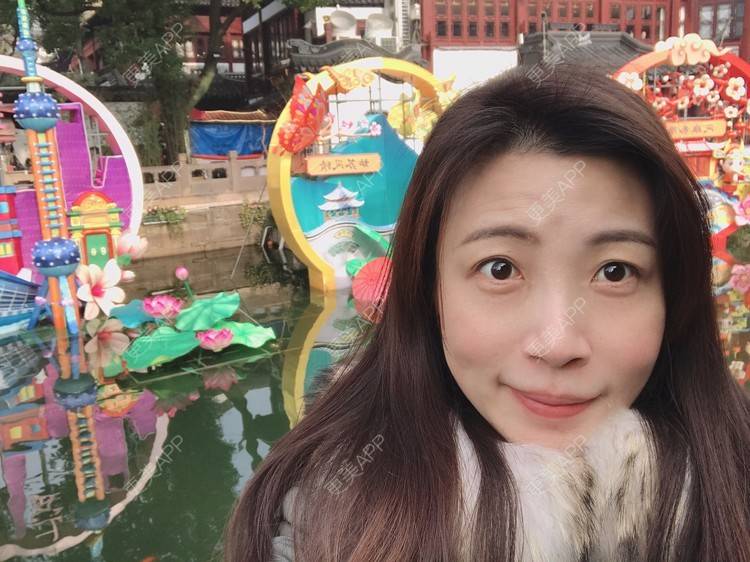 更美 - 更美用户bONdGip4QS的双眼皮经验 | 双眼皮 | 上海 | 眼部多项