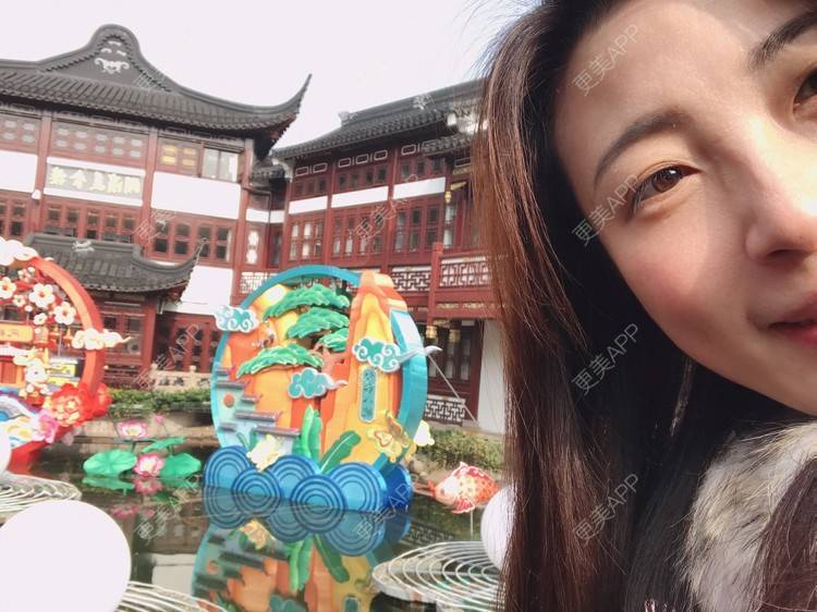 更美 - 更美用户bONdGip4QS的双眼皮经验 | 双眼皮 | 上海 | 眼部多项