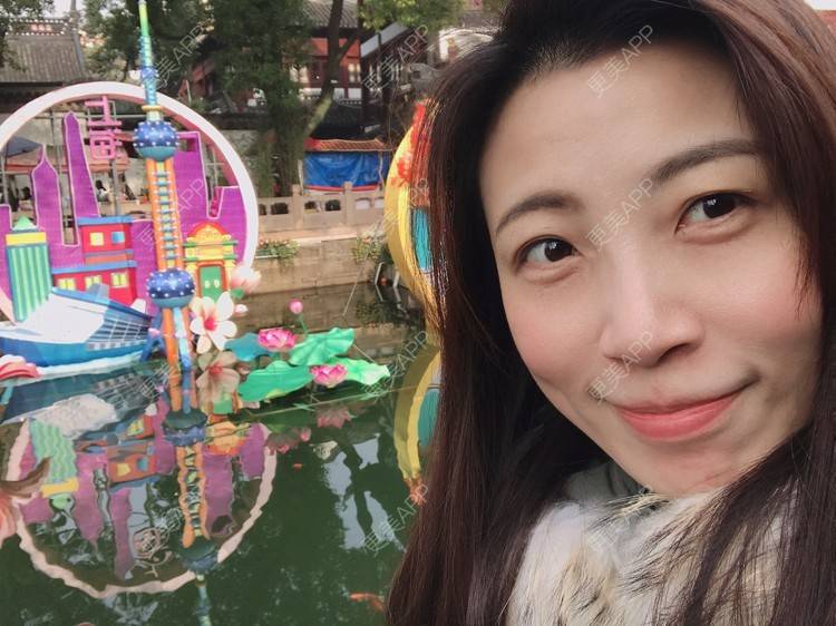 更美 - 更美用户bONdGip4QS的双眼皮经验 | 双眼皮 | 上海 | 眼部多项